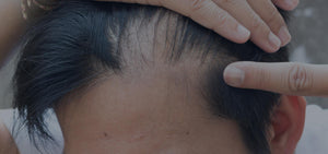 Natural Hair Treatment: Green Tea