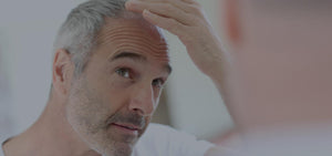 Hair Loss: Multiple Causes