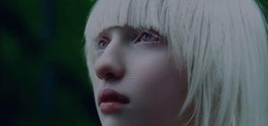 Albinism: Genetics, Causes, and Symptoms